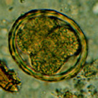 Ascaris eggs