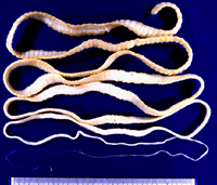 Tapeworm